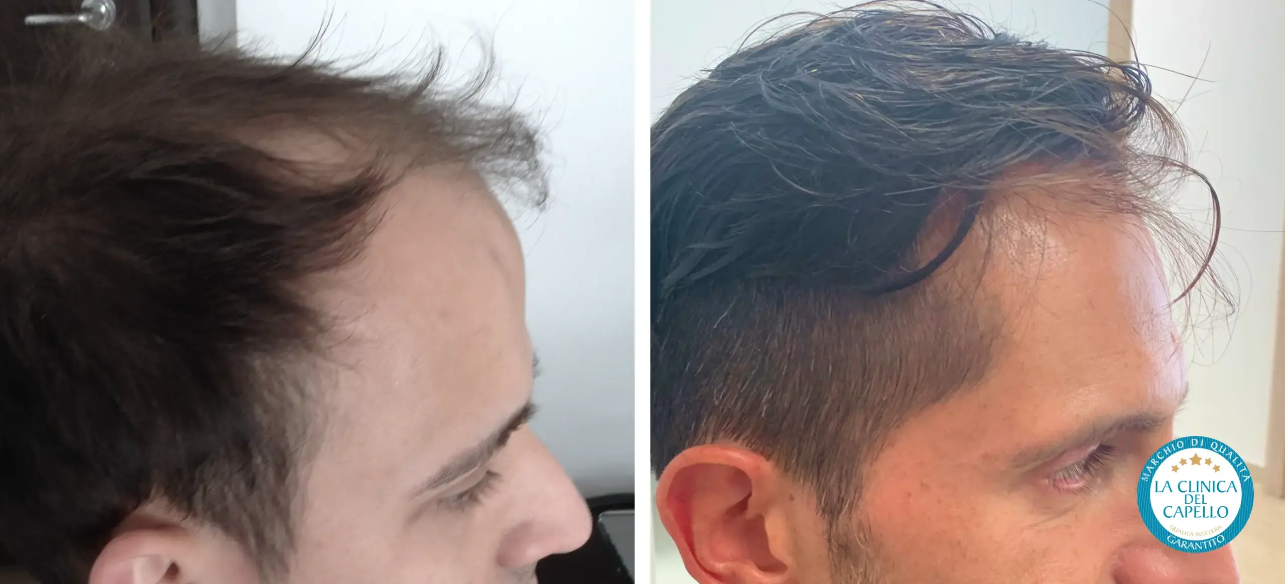Home - Prima e dopo 1.1