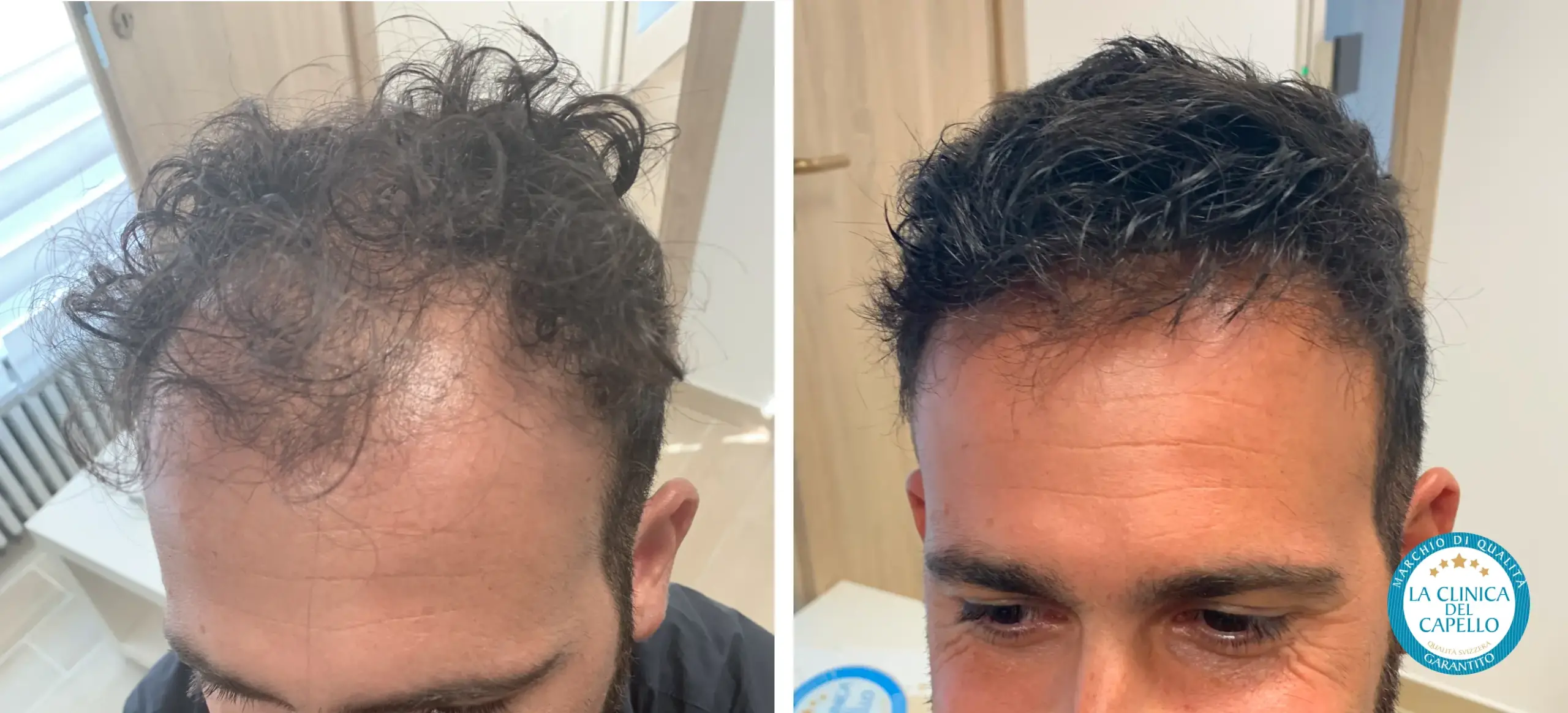 Home - Prima e dopo 2.1