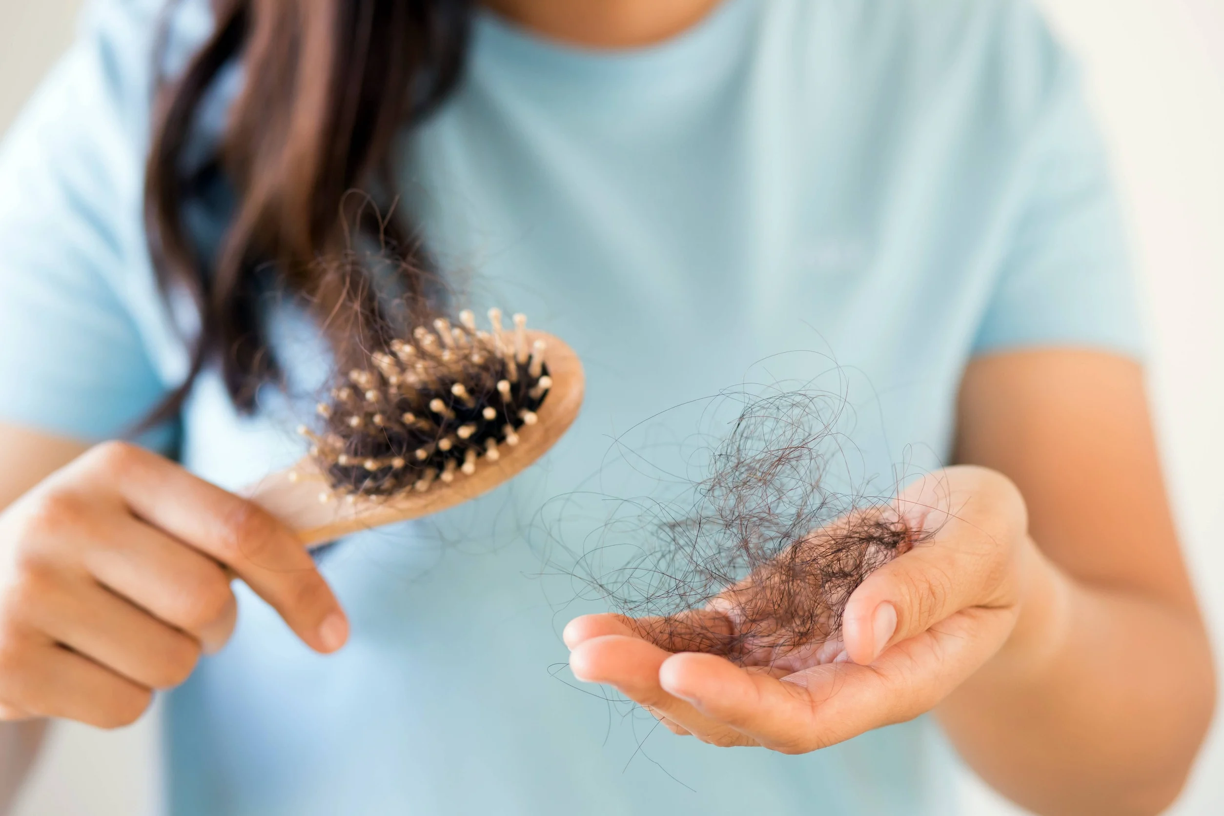 La presenza di molti capelli intrappolati nella spazzola è uno dei segnali della perdita di capelli