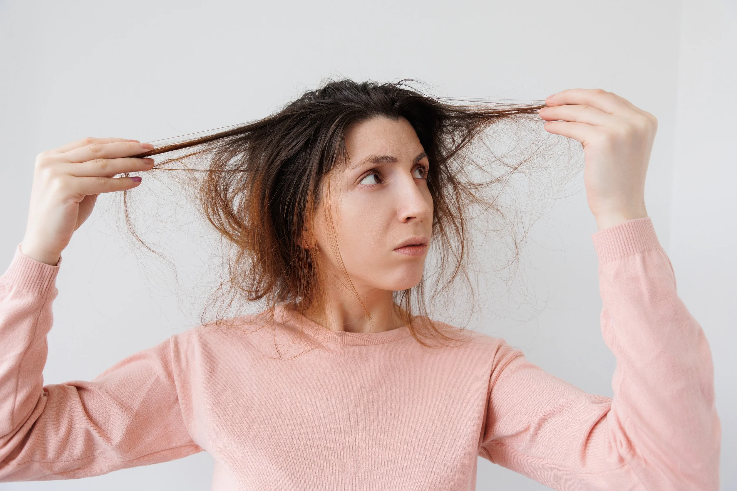 Una donna preoccupata dalla perdita dei capelli: una situazione molto comune.