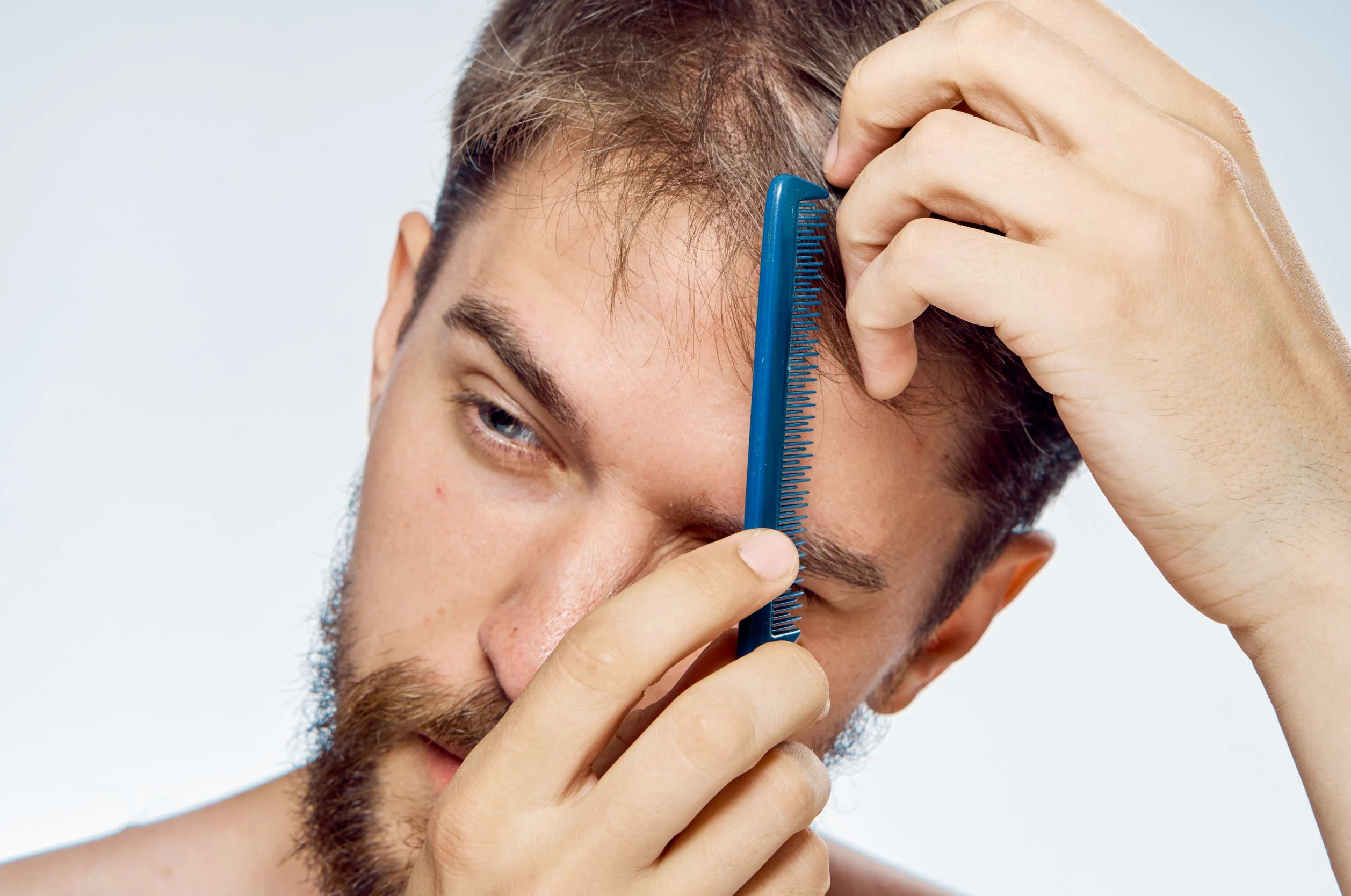 Un uomo perplesso di fronte ai diradamenti di capelli.