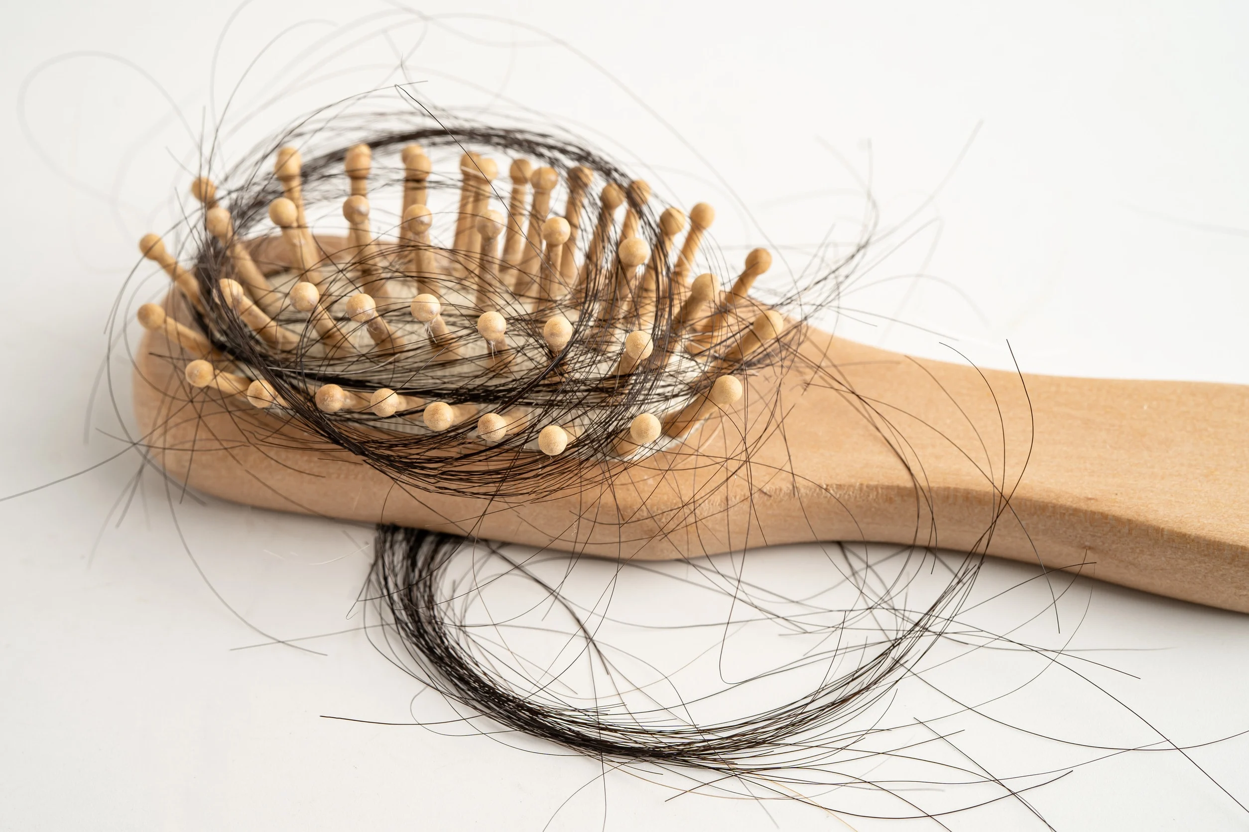 I capelli nella spazzola, un fenomeno che anticipa il diradamento