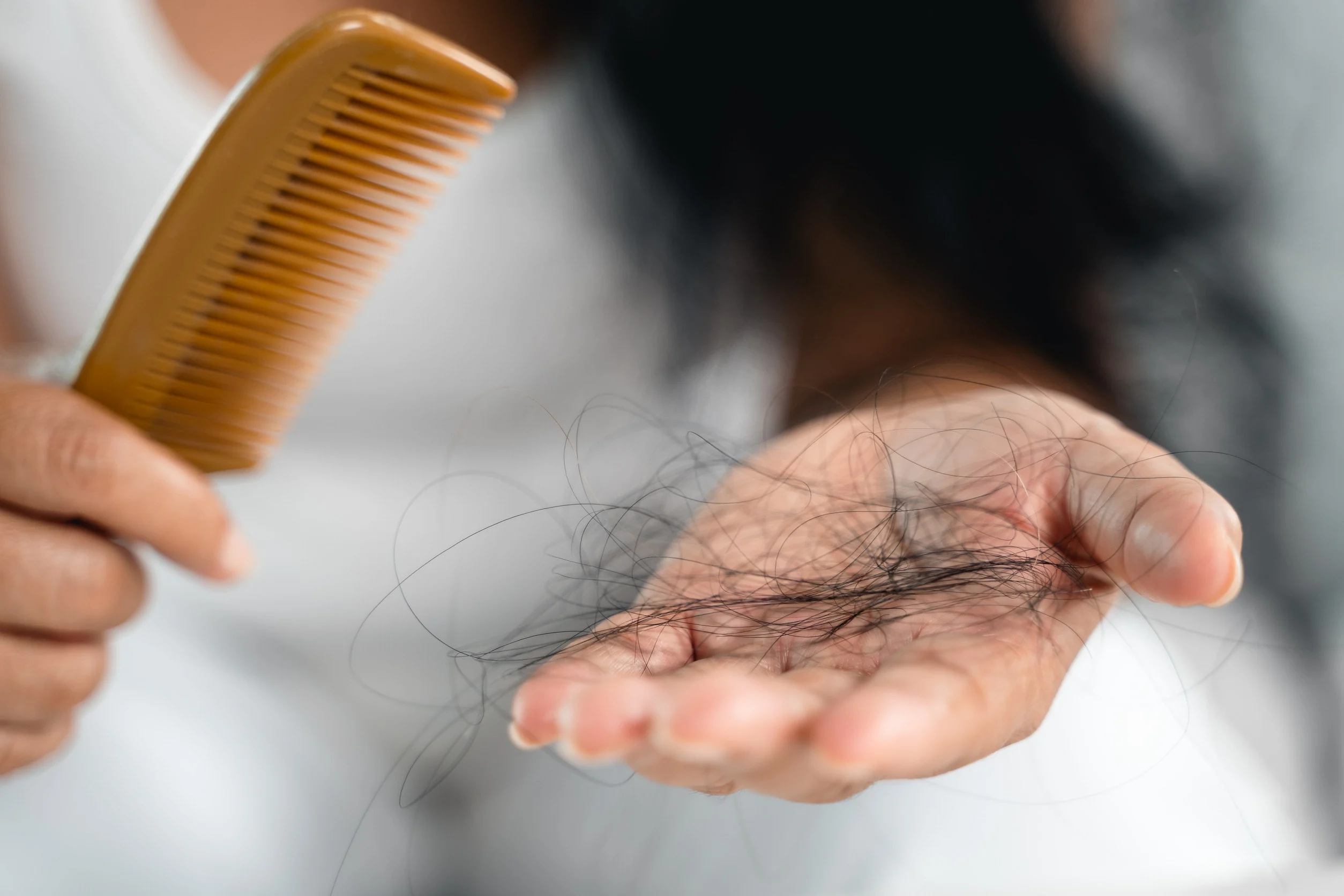 Il cambiamento stagionale è una causa naturale di perdita dei capelli.