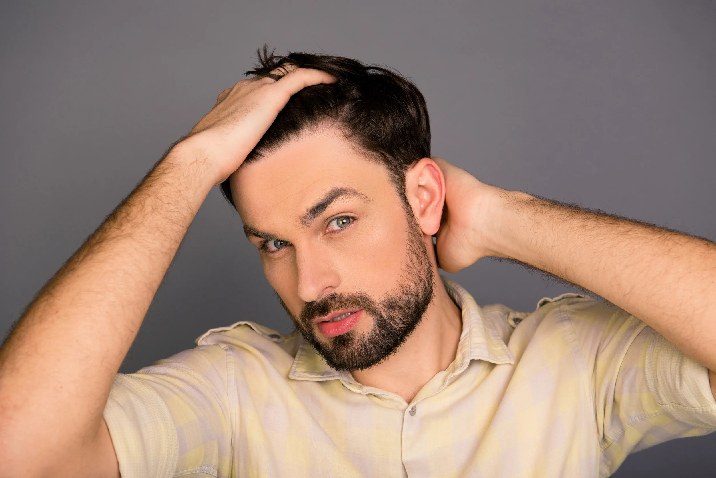 L'autotrapianto di capelli porta a risultati eccellenti per la stempiatura.