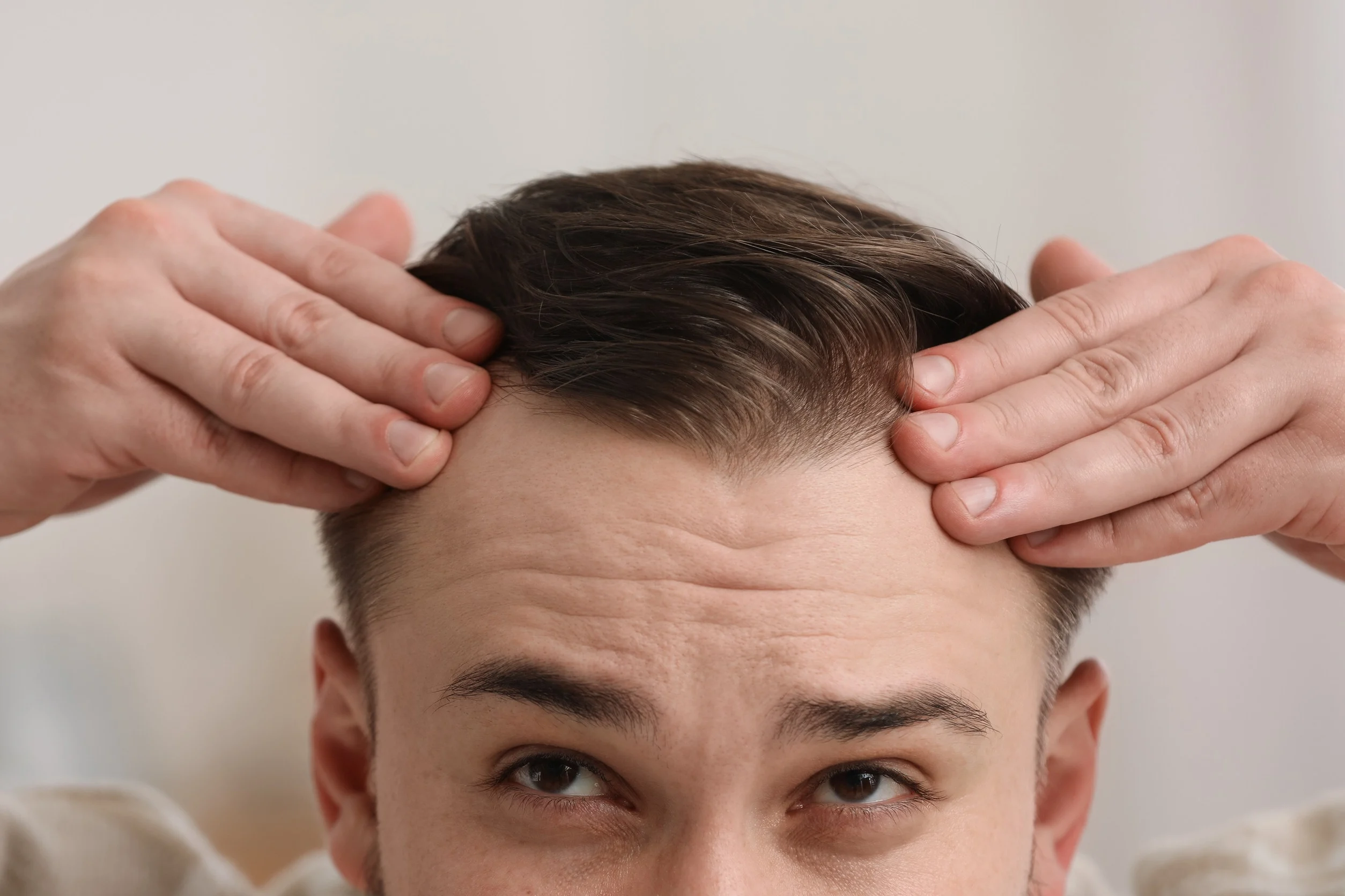 Un uomo che si controlla l'avanzamento della stempiatura e vuole porvi rimedio.