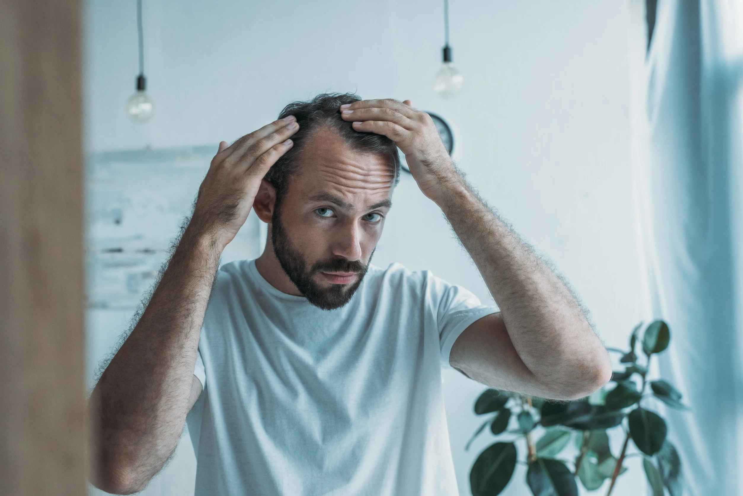 Un uomo non è immune alla caduta dei capelli per mancanza di ferro.
