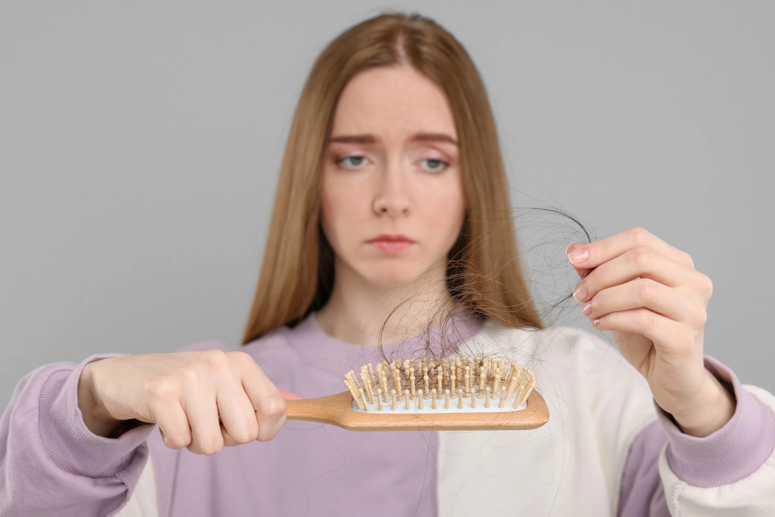 Una donna preoccupata per la perdita di capelli.