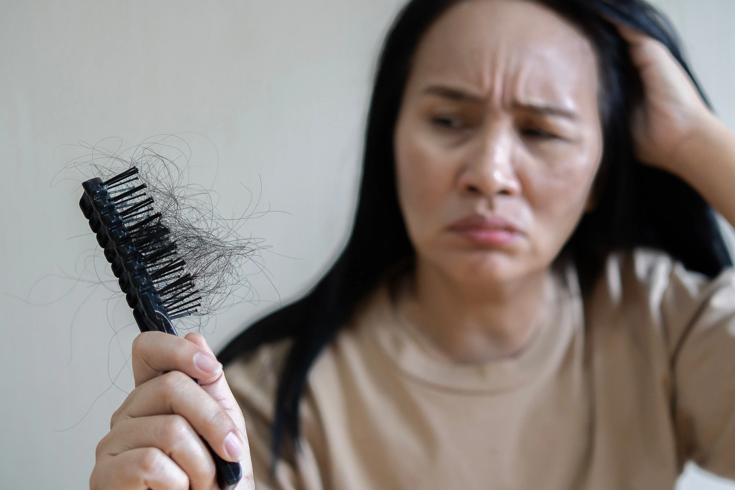 Una donna pallida e stanca, che perde capelli, è potenzialmente anemica.