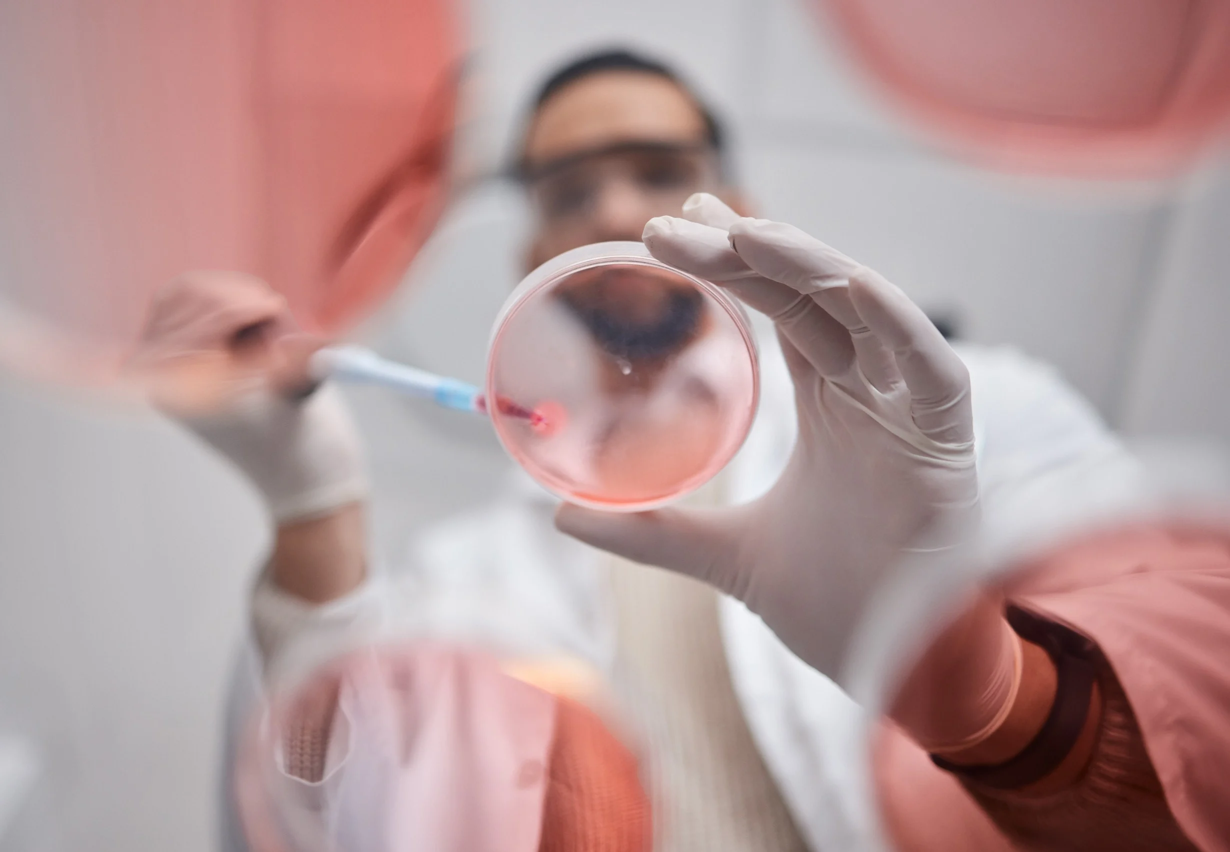 Un tricologo che utilizza il Plasma Ricco di Piastrine
